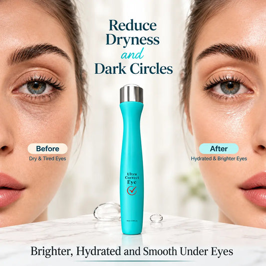 VINCE Ultra Correct Eye Roller - Before & After