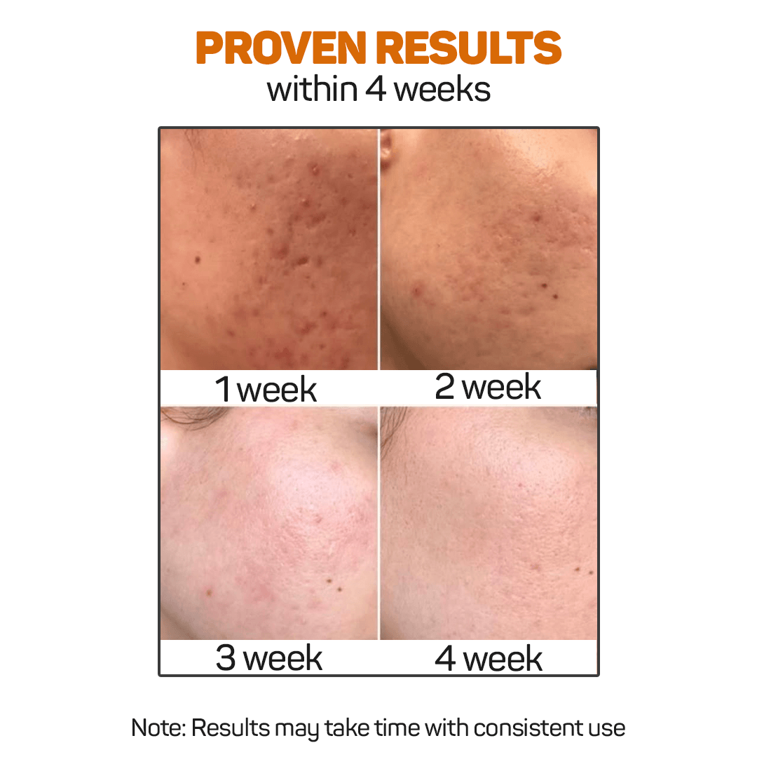 Vitamin C Serum Results