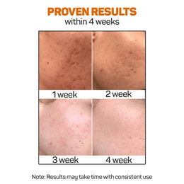 Vitamin C Serum Results