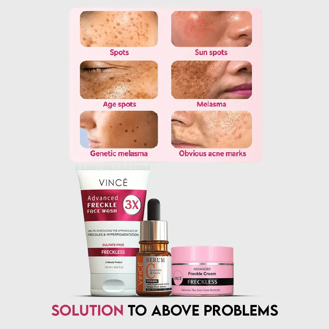 Buy Freckle Challenge Kit by VINCE